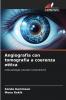 Angiografia con tomografia a coerenza ottica