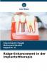 Ridge-Enhancement in der Implantattherapie