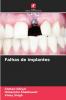 Falhas de implantes