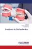 Implants in Orthodontics