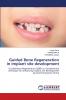Guided Bone Regeneration in implant site development