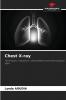 Chest X-ray