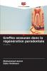 Greffes osseuses dans la régénération parodontale