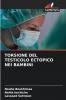 TORSIONE DEL TESTICOLO ECTOPICO NEI BAMBINI
