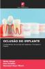 OCLUSÃO DO IMPLANTE