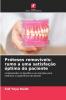 Próteses removíveis