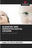 ALBINISM AND DERMATOLOGICAL LESIONS