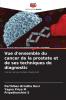 Vue d'ensemble du cancer de la prostate et de ses techniques de diagnostic