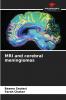 MRI and cerebral meningiomas