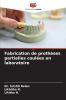 Fabrication de prothèses partielles coulées en laboratoire