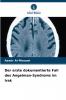 Der erste dokumentierte Fall des Angelman-Syndroms im Irak