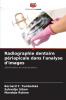 Radiographie dentaire périapicale dans l'analyse d'images