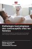 Pathologie toxicologique des contraceptifs chez les femmes