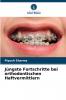 Jüngste Fortschritte bei orthodontischen Haftvermittlern