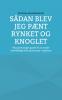 Sådan blev jeg pænt rynket og knoglet