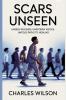 Scars Unseen