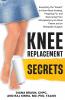 Knee Replacement Secrets