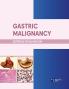 Gastric Malignancy