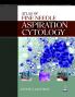 Atlas of Fine Needle Aspiration Cytology