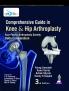 Comprehensive Guide in Knee & Hip Arthroplasty (Asia Pacific Arthroplasty Society - Delta Compendium)