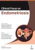 CLINICAL FOCUS ON ENDOMETRIOSIS