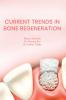 Current Trends In Bone Regeneration