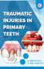 Traumatic Injuries in Primary Teeth