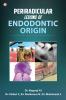 Periradicular lesions of Endodontic origin