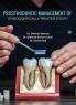 Prosthodontic Management of Endodontically Treated Tooth