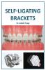 Self - Ligating Brackets