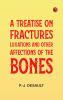 A Treatise on Fractures Luxations and Other Affections of the Bones