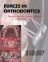 Forces in Orthodontics