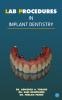 Lab Procedures in Implant Dentistry