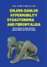 Ehlers-Danlos Hypermobile Dysautonomia and Fibromyalgia