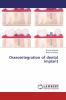 Osseointegration of dental implant