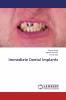 Immediate Dental Implants