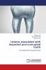 Lesions associated with impacted and unerupted tooth