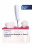 Periodontal Aspects of Dental Implants