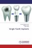 Single Tooth Implants