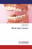 White Spot Lesions