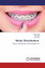 Molar Distalization
