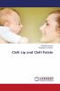 Cleft Lip and Cleft Palate