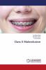 Class II Malocclusion