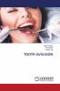 TOOTH AVULSION
