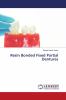 Resin Bonded Fixed Partial Dentures