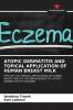 ATOPIC DERMATITIS AND TOPICAL APPLICATION OF HUMAN BREAST MILK