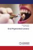 Oral Pigmented Lesions