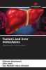 Tumors and liver metastases