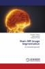 Brain MR Image Segmentation