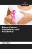 Breast Cancer